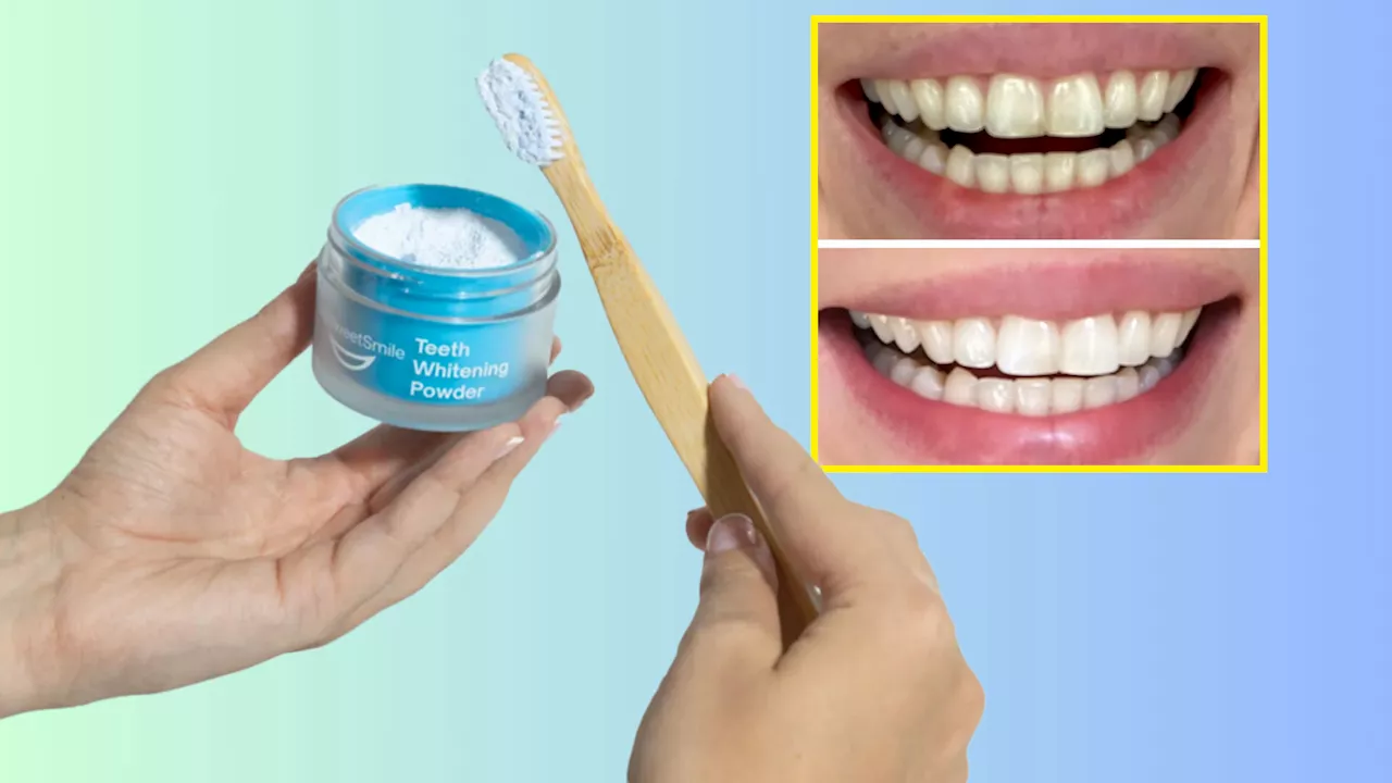 MySweetSmile Teeth Whitening Bundle Offers Long-Lasting Results in Winter Sale