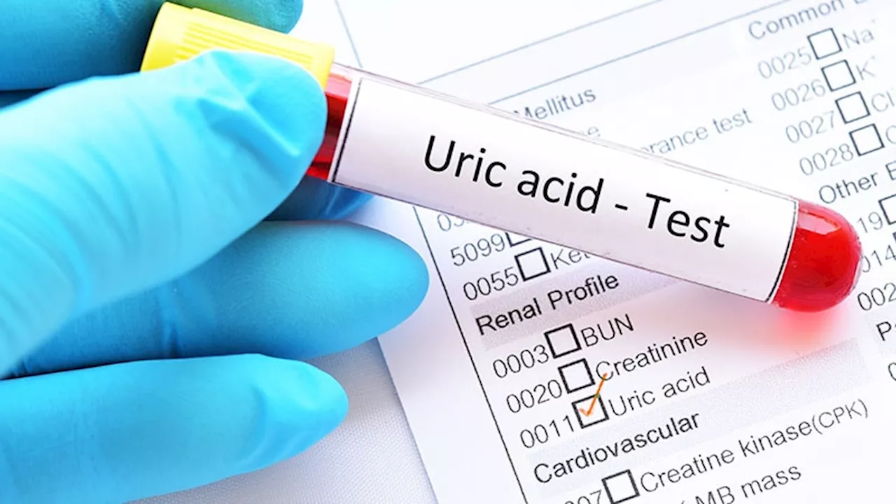 Serum Uric Acid Levels Predict NAFLD Risk in Nonobese Young Adults