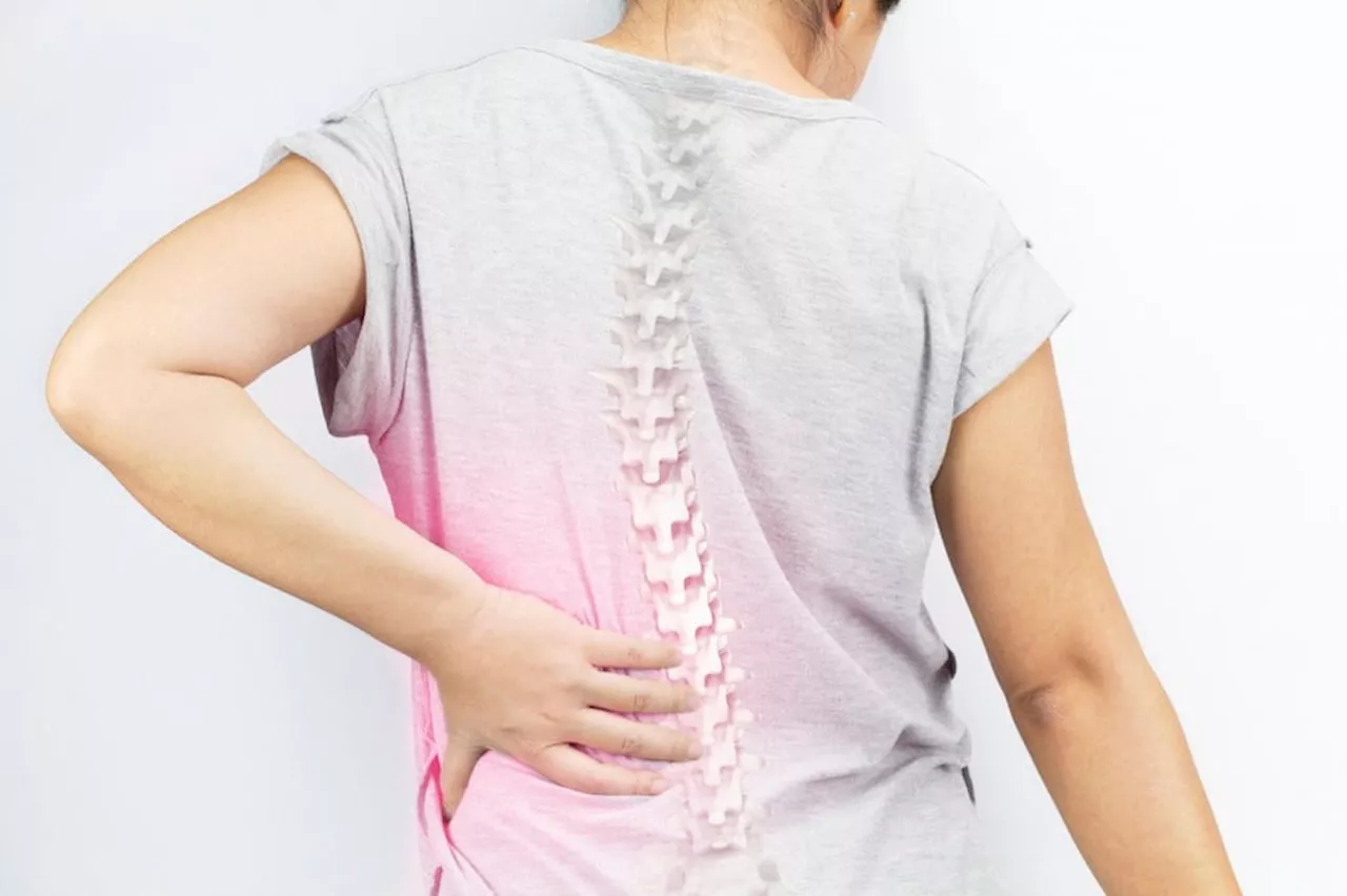 Una adolescente necesita urgentemente cirugía para combatir la escoliosis neurogénica.