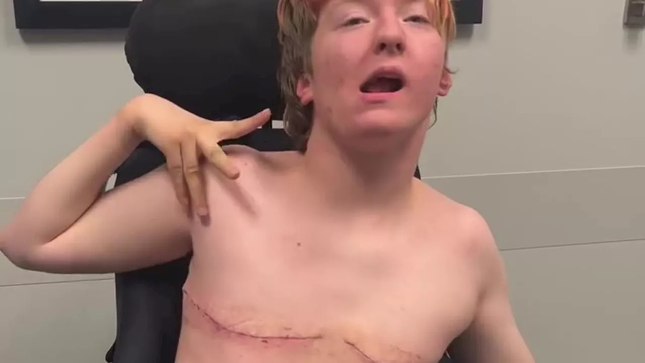 Transgender Teen With Cerebral Palsy Sparks Debate After Sharing Mastectomy Videos