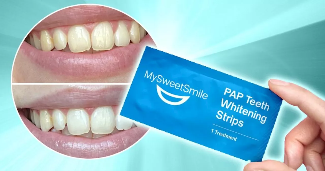 I tested peroxide-free teeth whitening strips users call 'the best on the market' for a brighter smile – but how did they fare on my sensitive teeth?