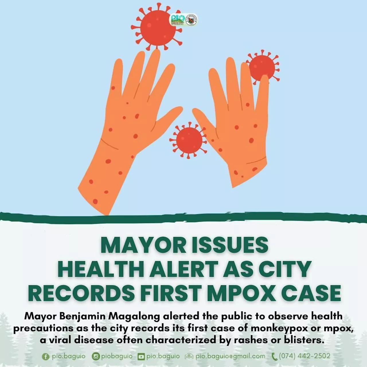 Baguio logs first Mpox case; don’t panic