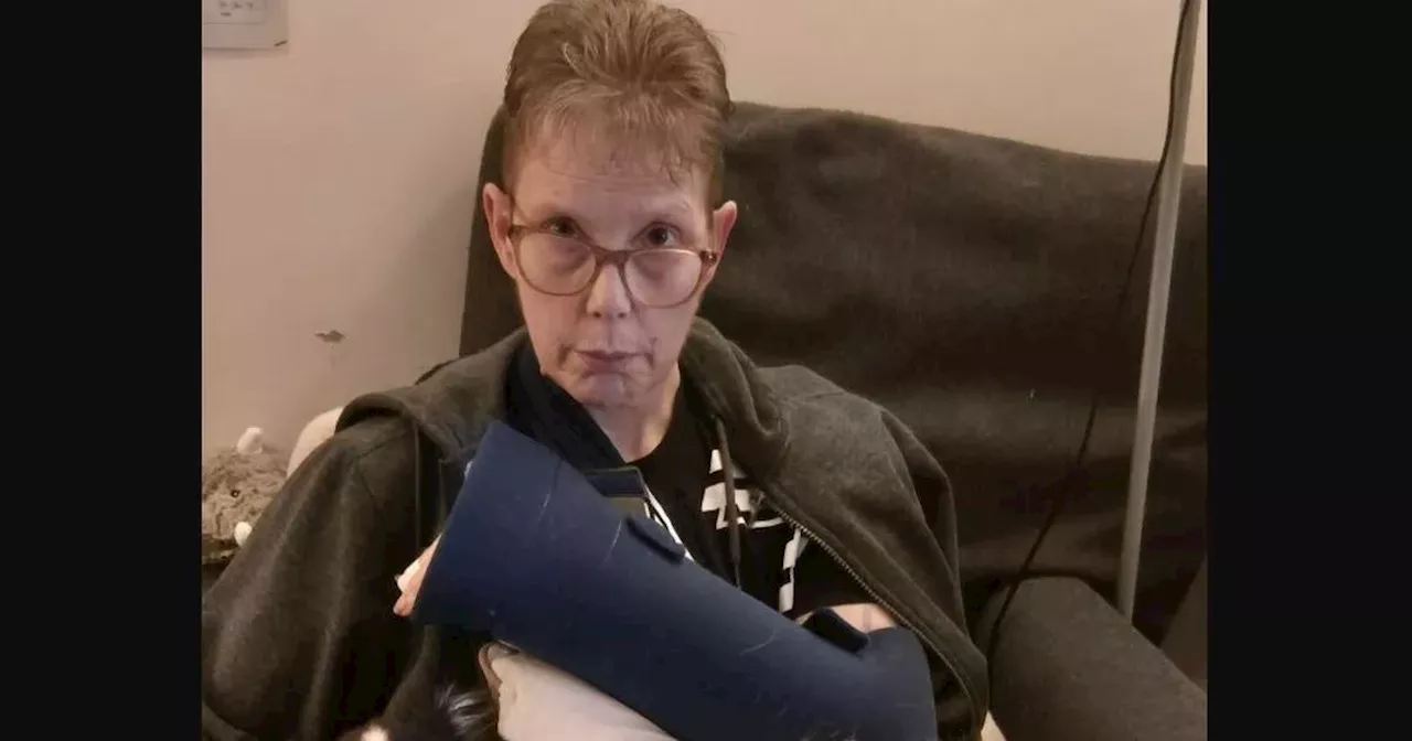 'I was not letting my Pomeranian die without a fight': Woman breaks arm in three places 'saving her dogs from Bully breeds'