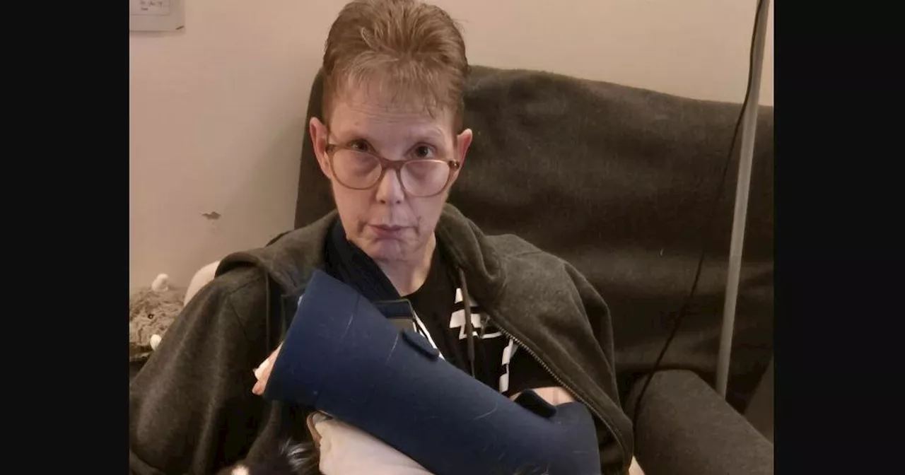 Woman breaks arm in three places 'saving her dogs from Bully breeds'