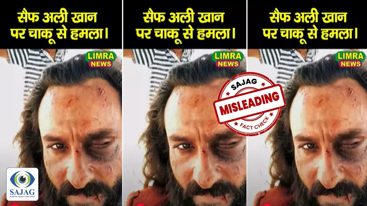 Fact Check: आंख और चेहरे पर चोट के निशान, हमले के बाद वायरल हुई सैफ अली खान की इस तस्वीर का सच जानिए