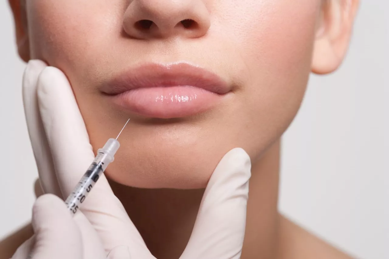 Coquitlam nurse fined $30K for lying about Botox injections