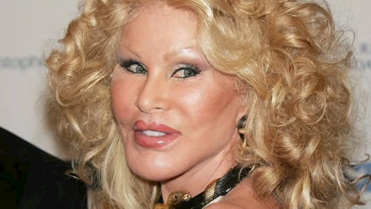 Muore Jocelyn Wildenstein, la 'donna gatto'