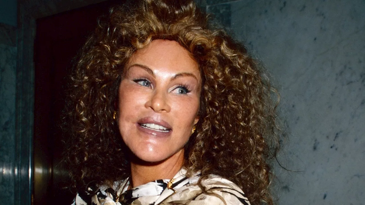 Jocelyn Wildenstein, 'Catwoman' Socialite Known for Extreme Cosmetic Surgery, Dies