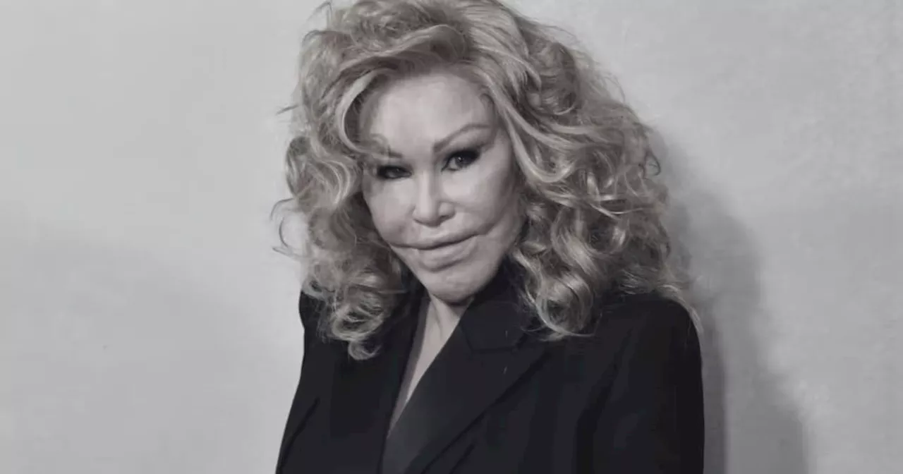 Jocelyn Wildenstein, die „Katzenlady“, ist gestorben