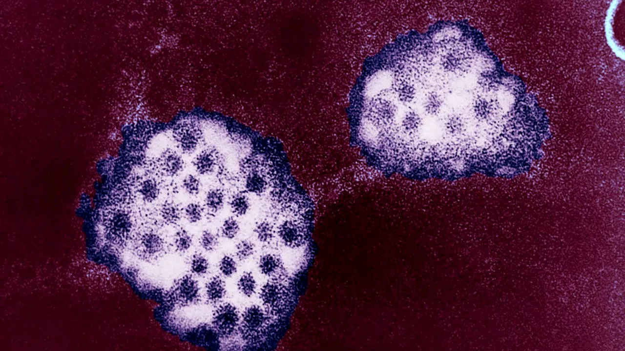 Norovirus Cases Surge in the US this Winter