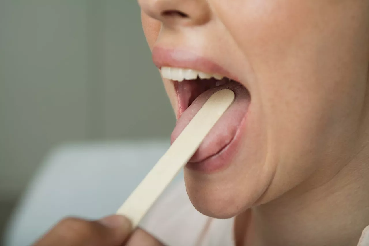 Regrown Tonsils Cause Decades-Long Sore Throat