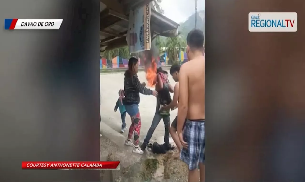 Batang babae, nalapnos sa mukha at katawan nang matumba at magliyab ang sinasakyang motorsiklo