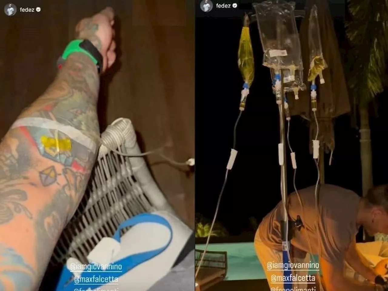 Fedez con la flebo al braccio a Capodanno: il rapper rispolvera il vecchio trend del vitamin drip