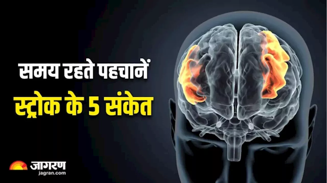 स्ट्रोक के पहले आने वाले संकेत