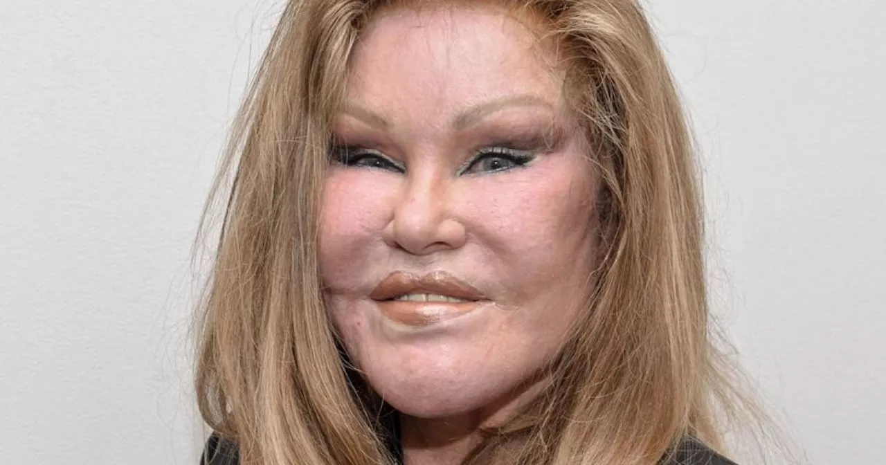 Jocelyn Wildenstein, 'Katzenfrau', stirbt im Schlaf