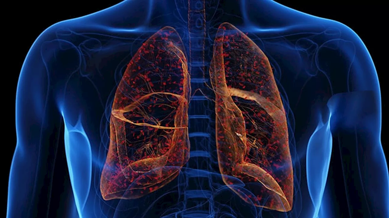 Imipenem-Cilastatin-Relbactam Shows Noninferiority to Piperacillin-Tazobactam in Treating Critically Ill Patients with Pneumonia