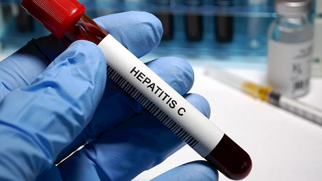 Treating Hepatitis C Promptly More Important Than Liver Staging, Study Finds