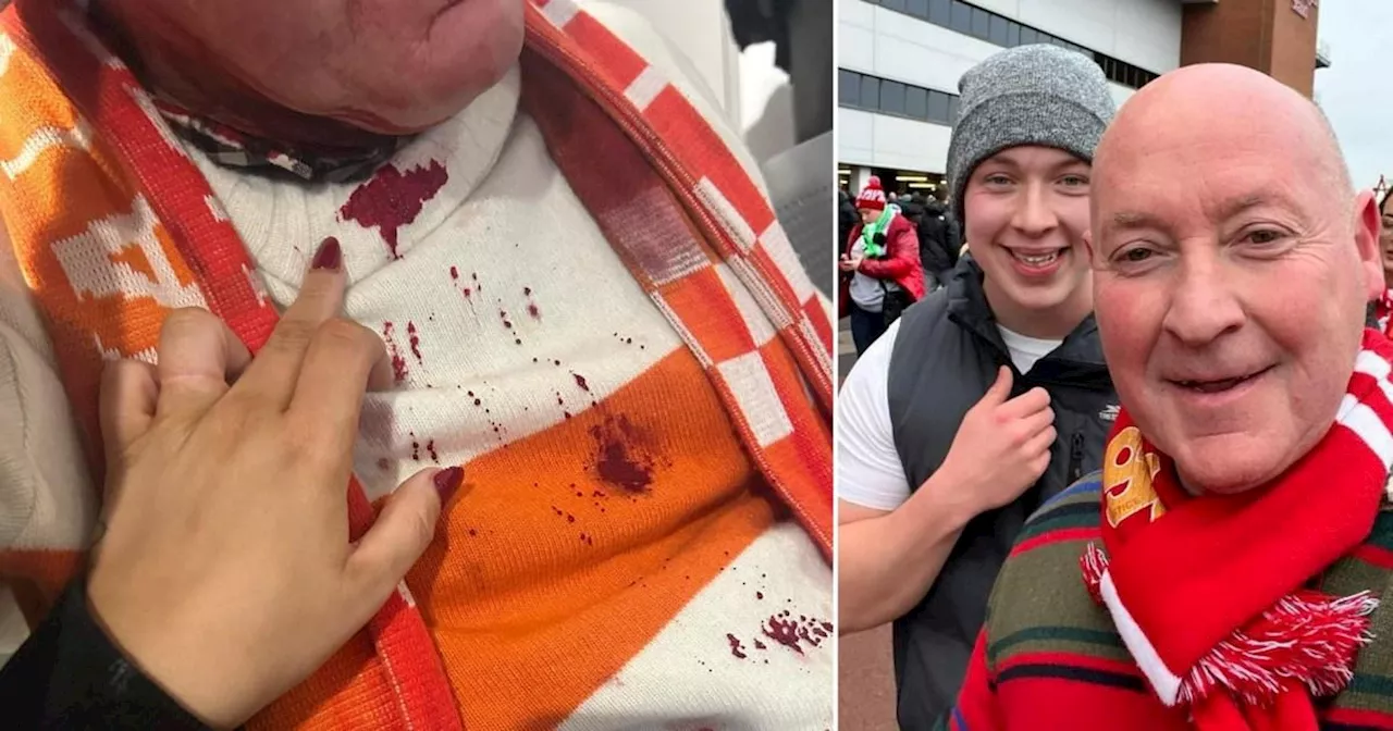 Liverpool Fan 'Lucky to Be Alive' After Attack by Manchester City Supporter