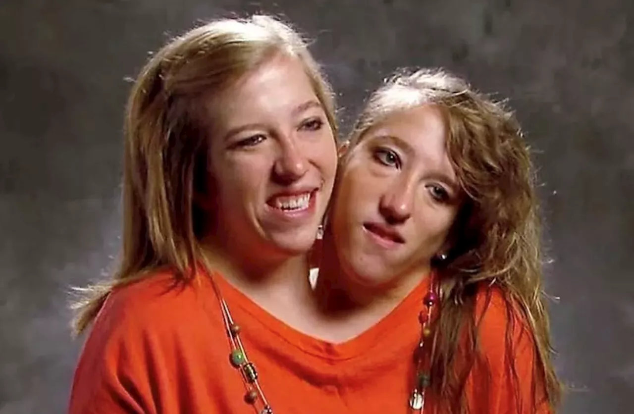 Conjoined Twins Abby and Brittany Hensel Share Insight Into Their Unique Life