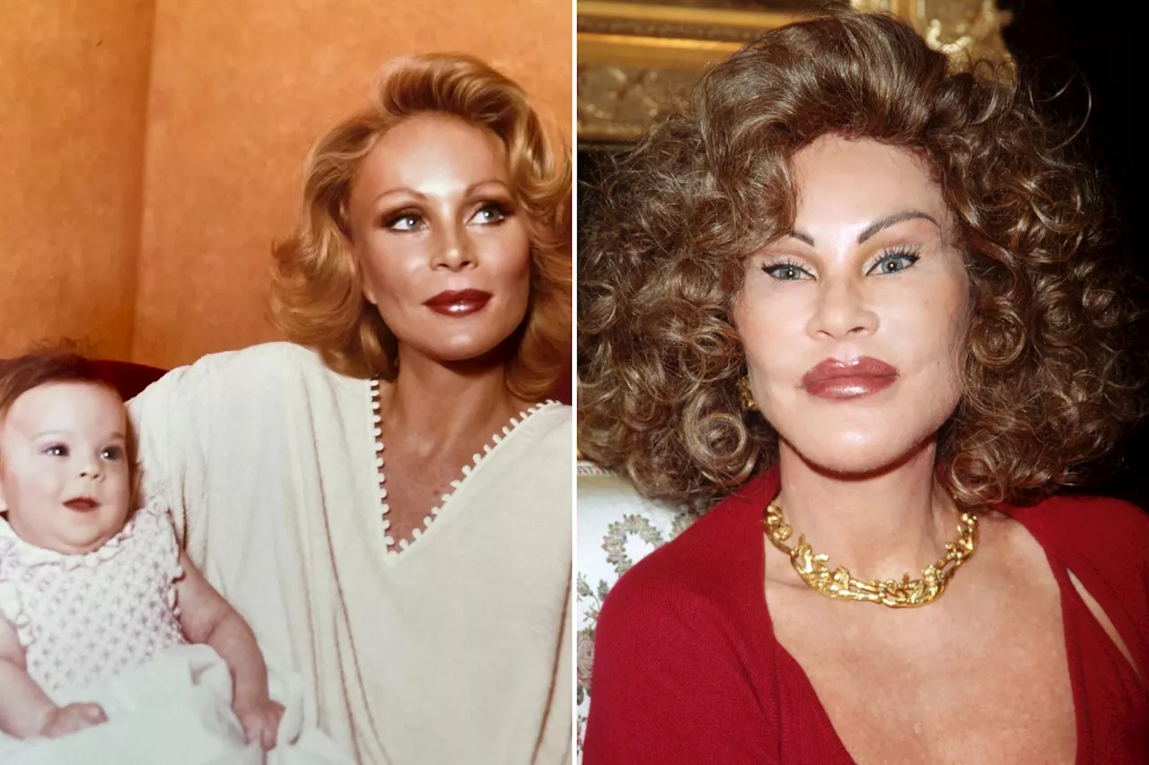 Jocelyn Wildenstein: A Cautionary Tale of Plastic Surgery Obsession