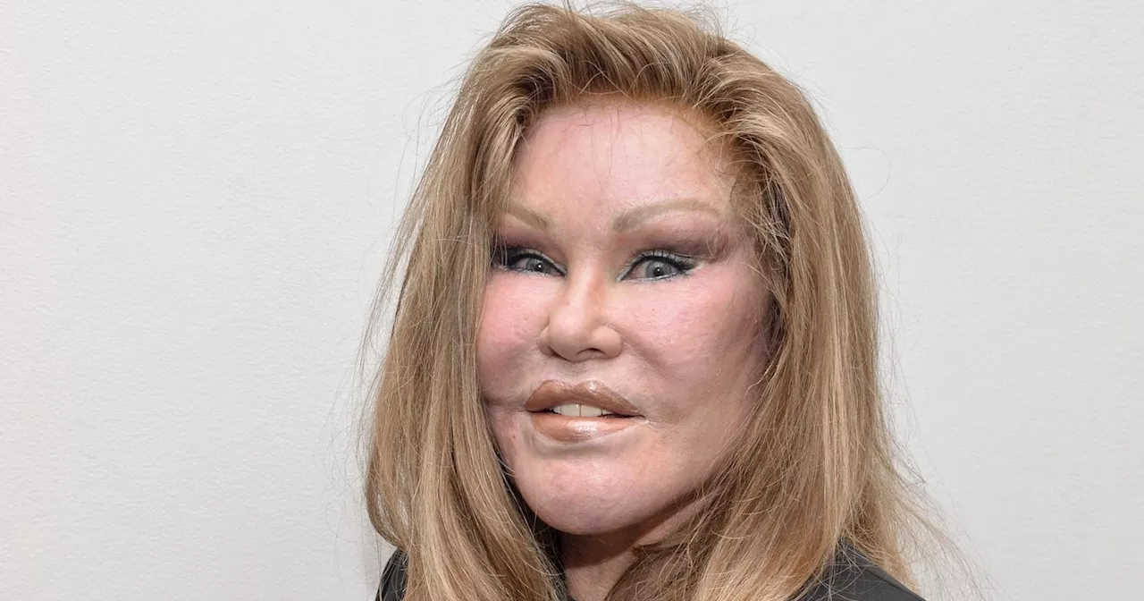 Jocelyn Wildenstein, 'Catwoman' Socialite, Filmed Reality Show Before Death