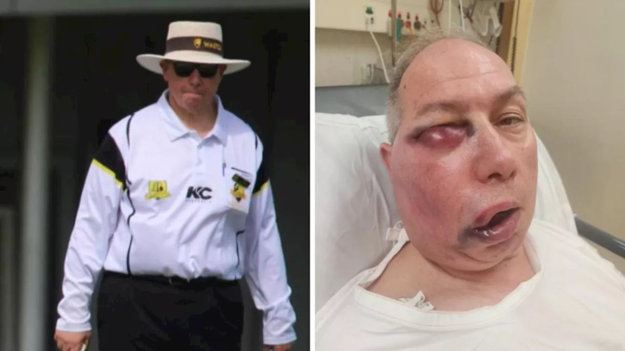 Veteran Cricket Umpire Makes Comeback After Freak Accident