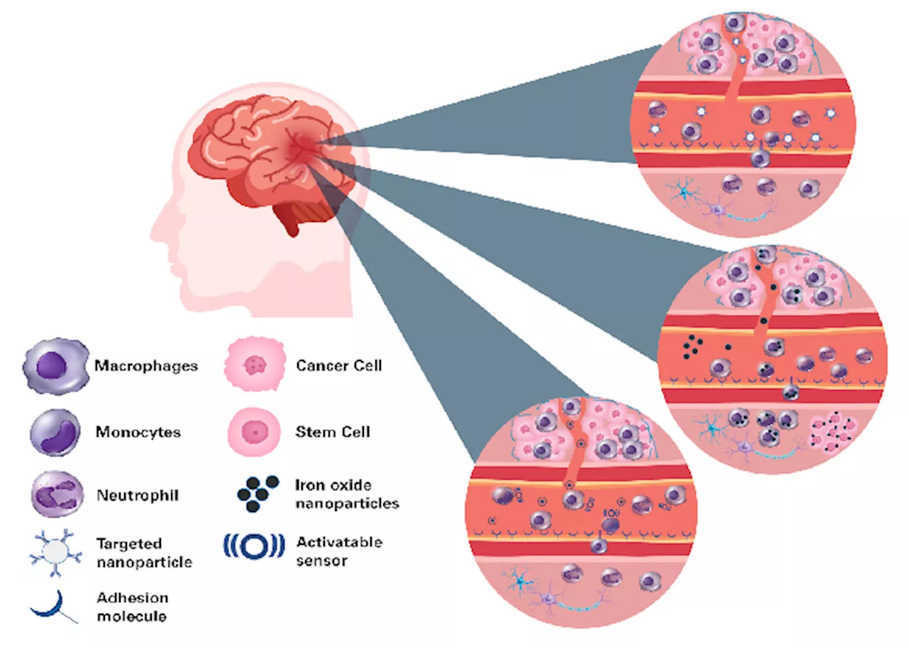 Bruker BioSpin's Preclinical Imaging Tools Advance Neurological Disease Research