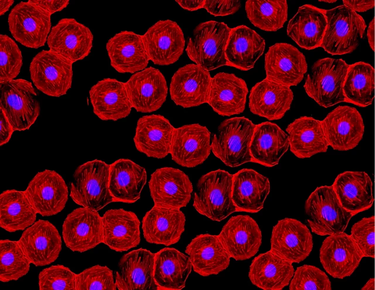 Confocal-Based High-Content Imaging: Revolutionizing Core Facility Research