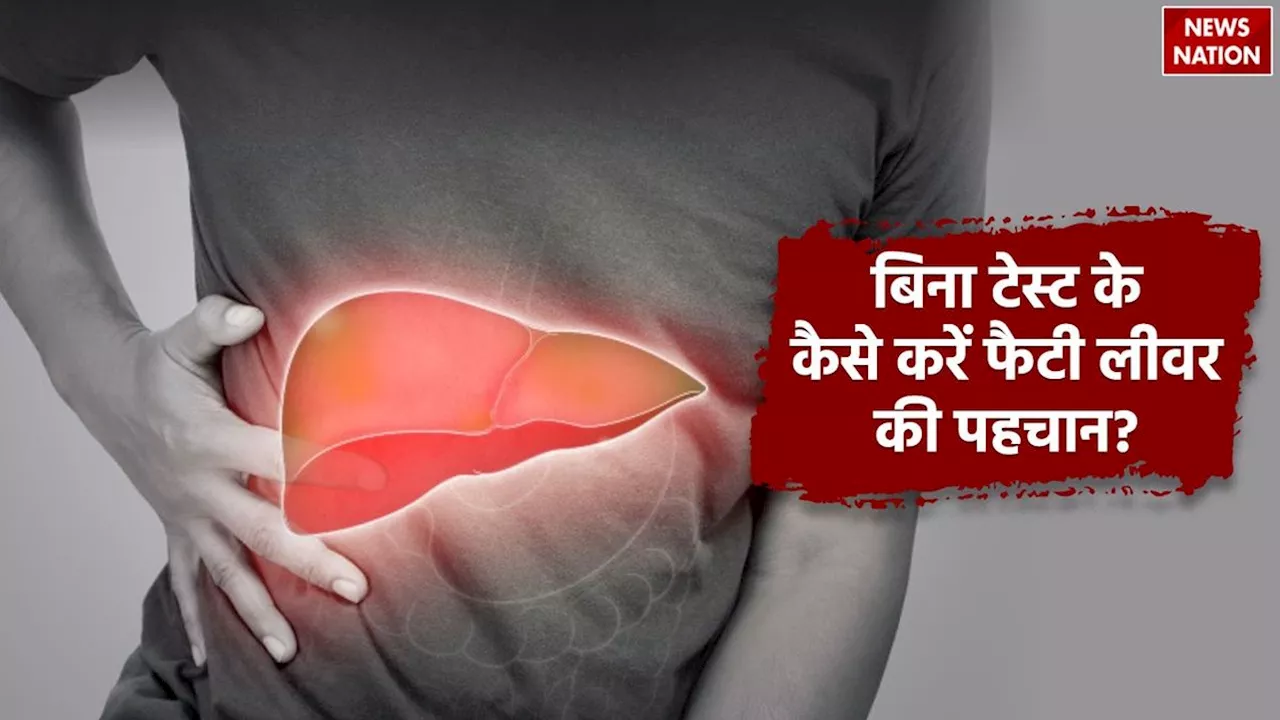 बिना टेस्ट के कैसे करें Fatty Liver की पहचान? ऐसे संकेत दिखने पर हो जाएं सावधान