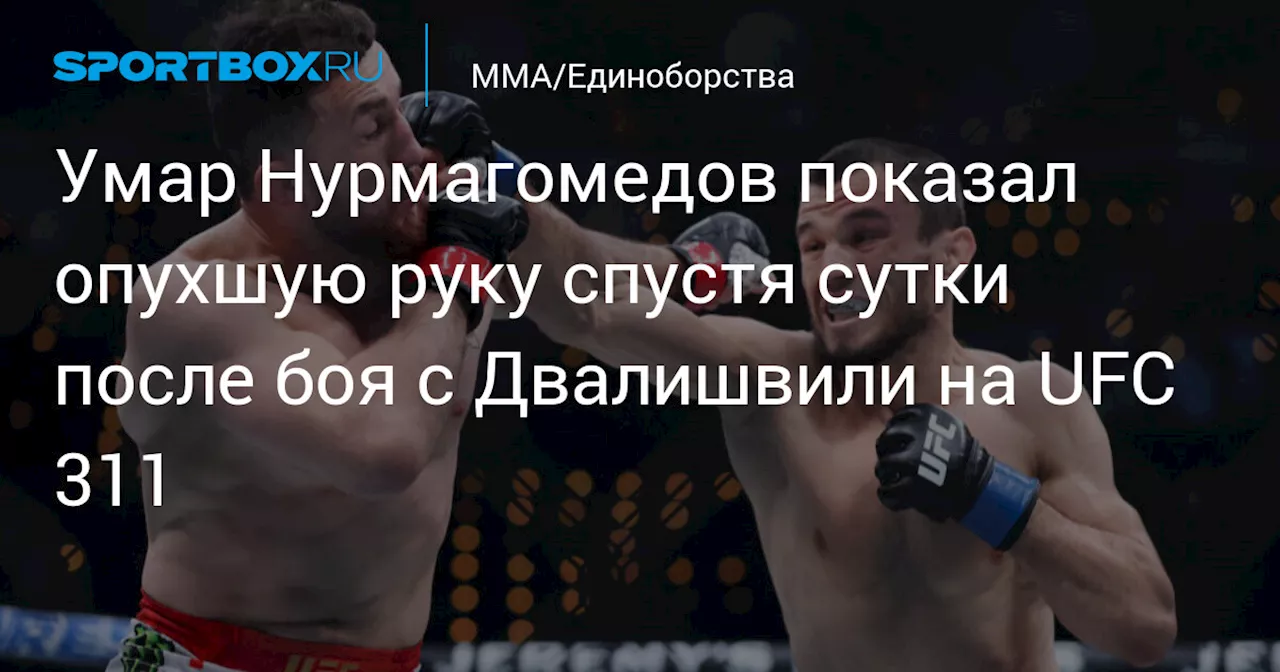 Умар Нурмагомедов показал опухшую руку спустя сутки после боя с Двалишвили на UFC 311