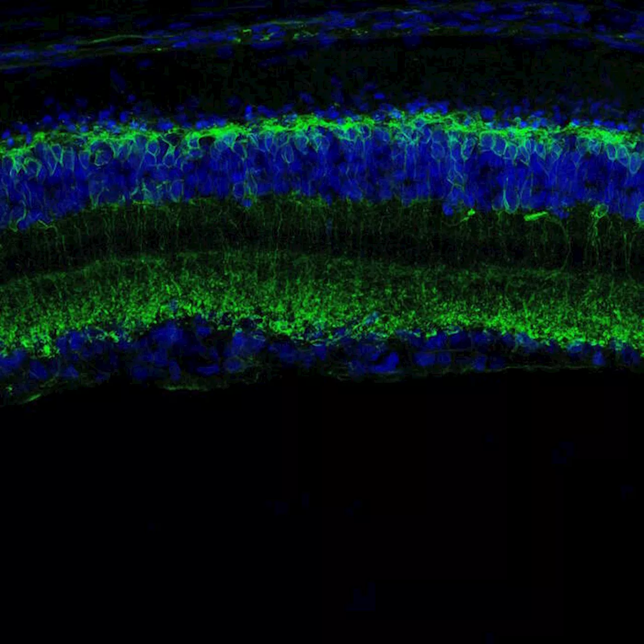 Interuttore Molecolare Ricostruisce la Vista Nei Pacient con Malattie Degenerative della Retina