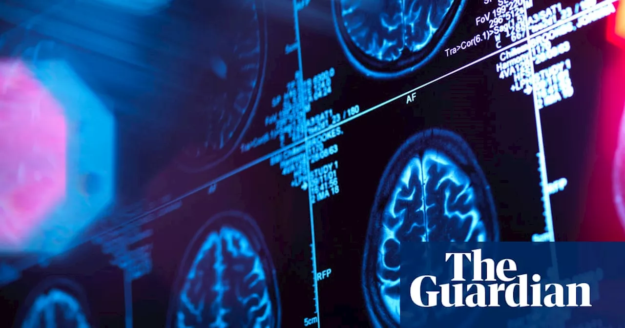 Could Existing Drugs Hold the Key to Fighting Dementia?