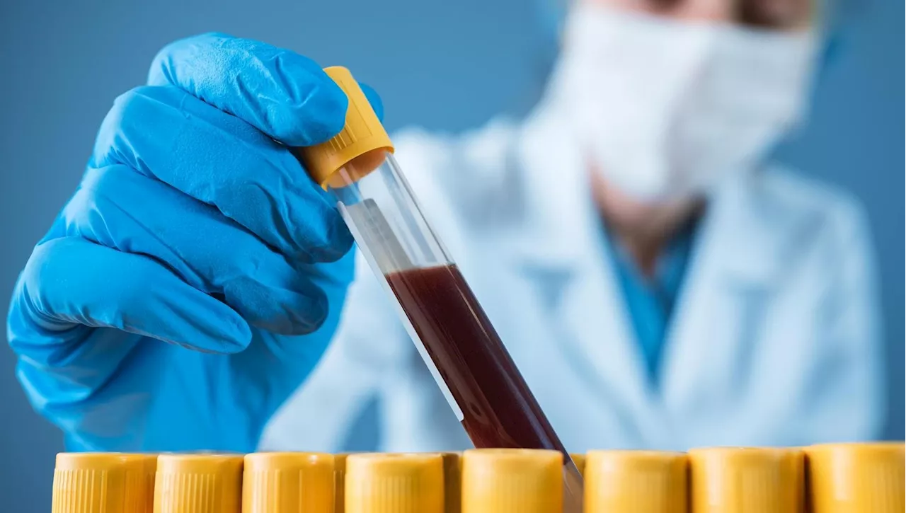 Biopsia Liquida: La Promessa di un Test del Sangue per la Diagnosi Precoce del Cancro del Colon-Retto