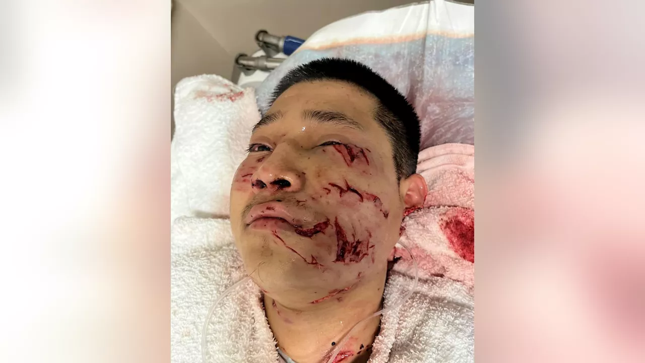 San Jose K-9 rips off man's earlobe, exclusive video shows