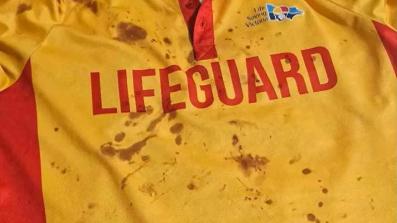 Appeal for witnesses after teens brutally attack young lifeguard at Melbourne pool