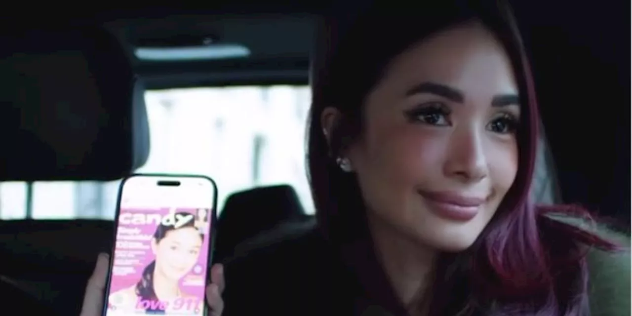 Heart Evangelista Denies Face Plastic Surgery, Confirms Only Lips Done