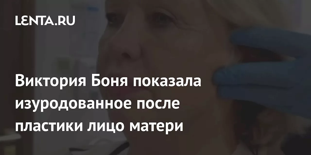 Боня показала изуродованное лицо матери после неудачной пластики