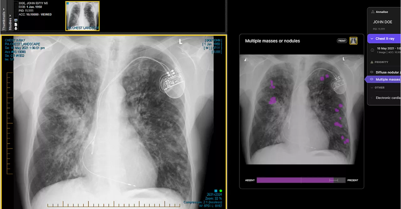 Australian medical imaging clinics using AI for X-rays