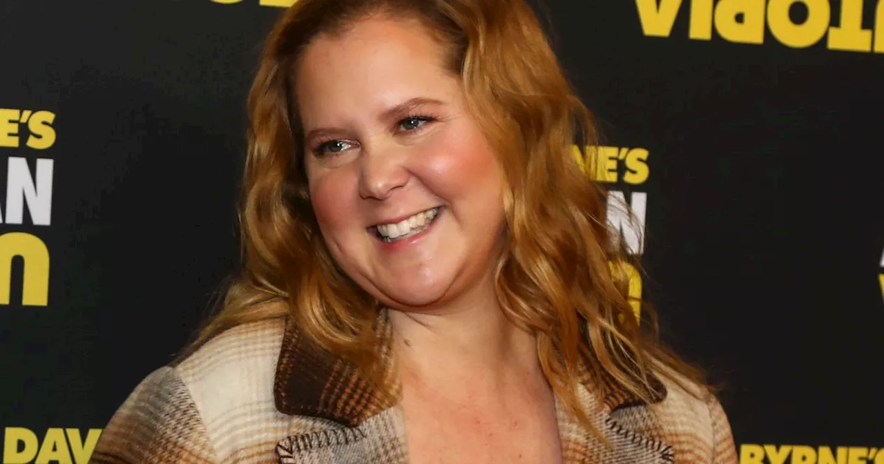 Amy Schumer Says Online Comments About ‘Swollen Face’ Helped Diagnose Cortisol Condition