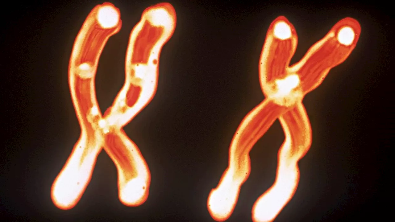 Faster brain aging tied to X chromosome inherited from Mom
