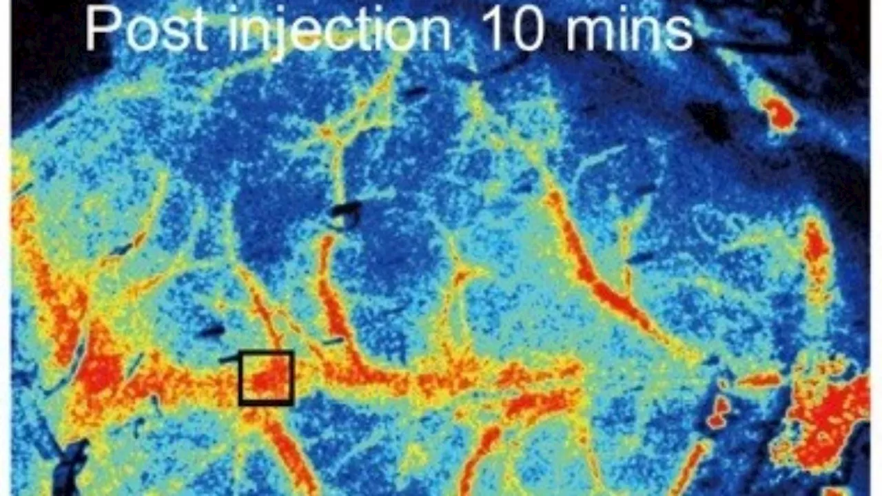 Mikroplastik im Gehirn: Neue Studie zeigt mögliche neurologische Risiken