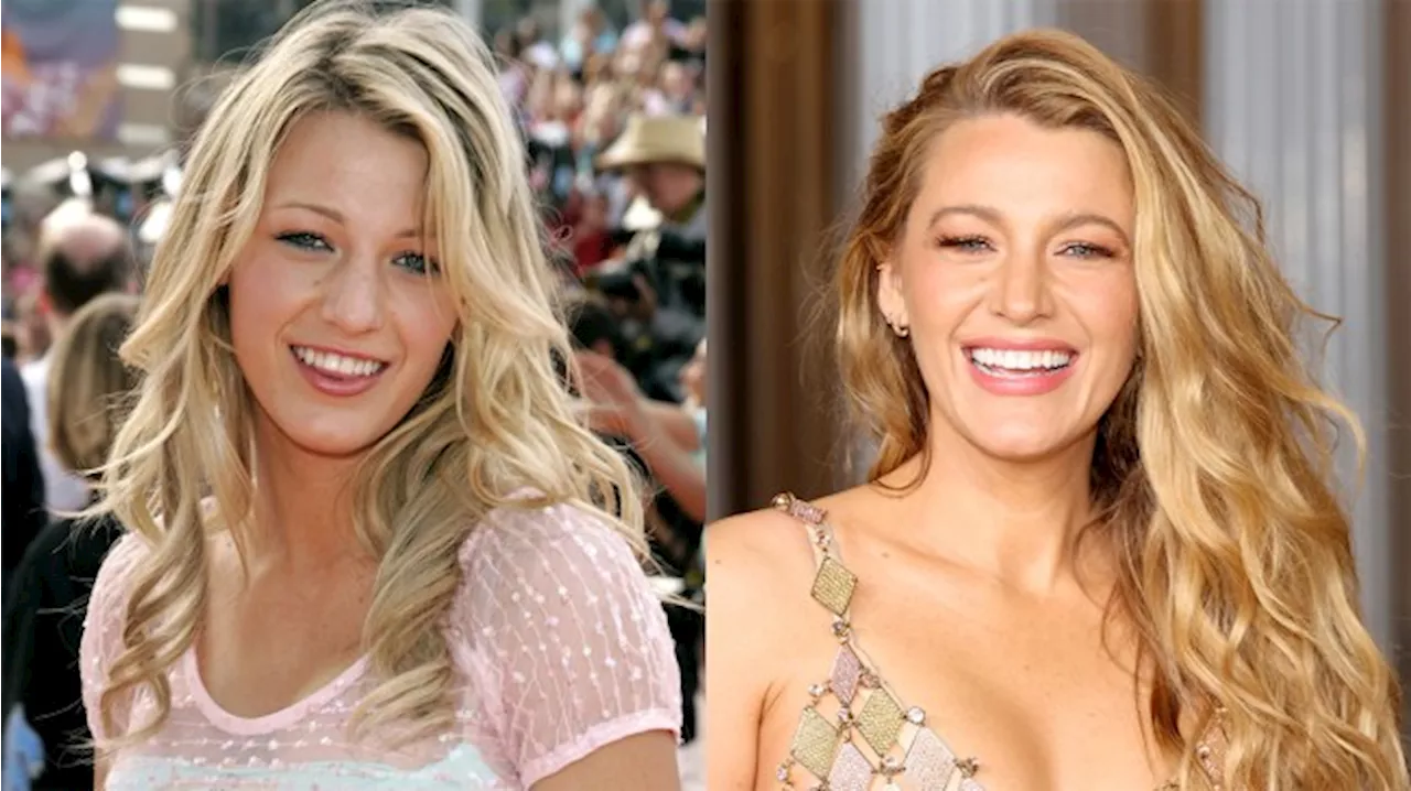 Blake Lively's Plastic Surgery Rumors Resurface After Leaked Video