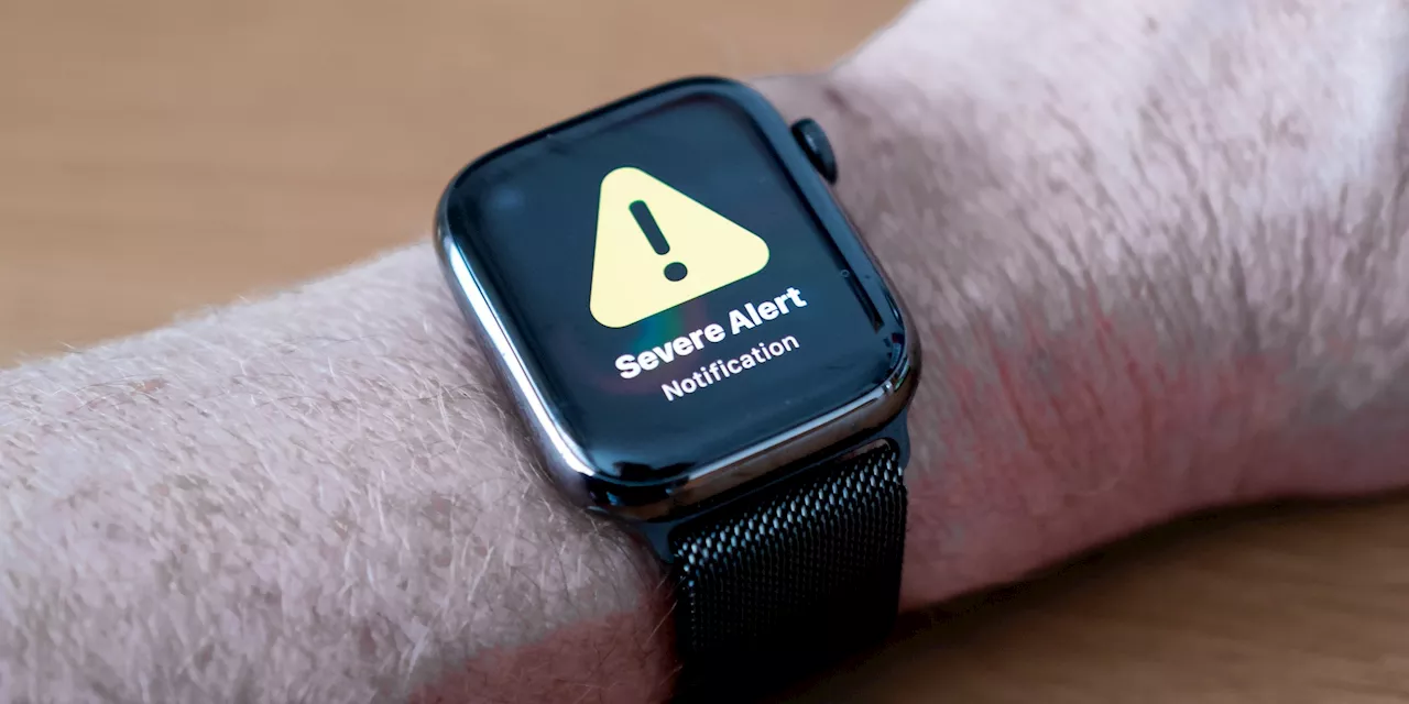 Apple Sued Over 'Forever Chemicals' in Apple Watch Bands