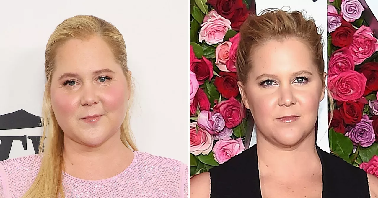 Amy Schumer Learned She Has Cushing Syndrome Because of Online Trolls