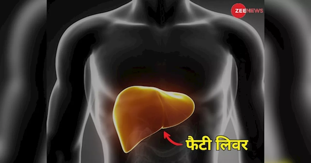 Fatty Liver के इन 5 लक्षणों को न करें नजरअंदाज, घर बैठे इस तरह कर सकते हैं जांच