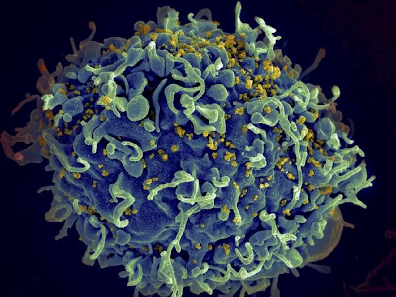 New HIV Vaccine Discovery Could Lead to Breakthrough