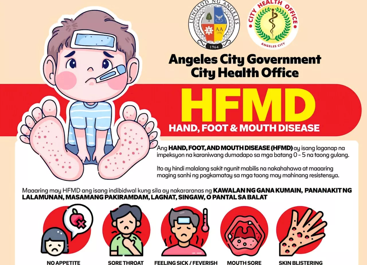 Angeles City Issues Health Advisory Amid Suspected HFMD Cases