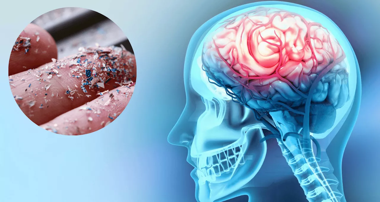 Microplásticos en el cerebro: Un nuevo riesgo para la salud