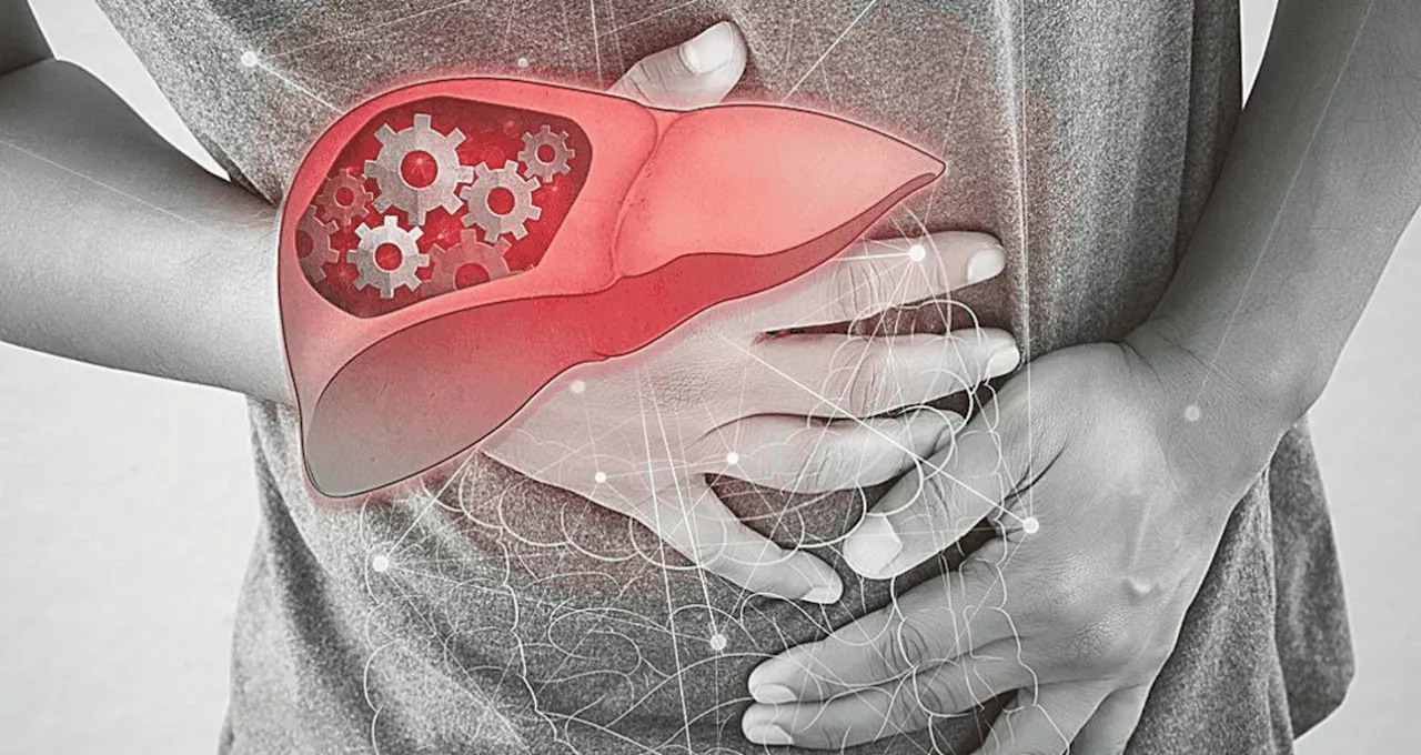 Porfiria Hepática Aguda: El desafío de diagnosticar una enfermedad rara y potencialmente mortal