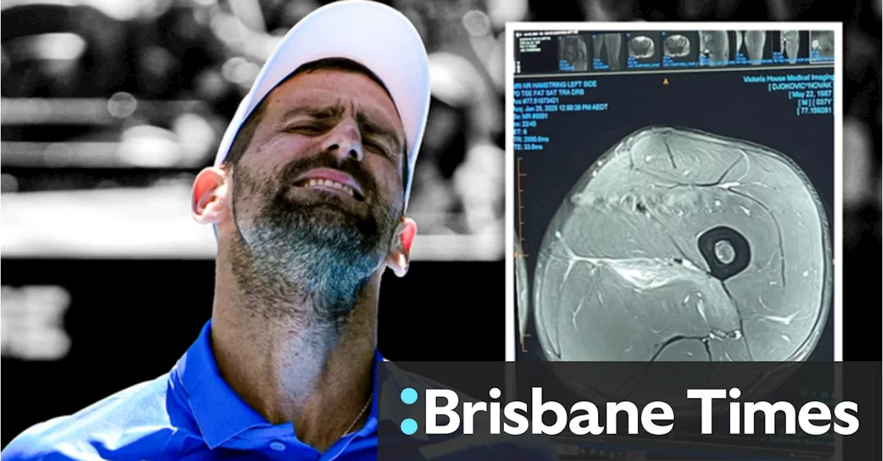 Djokovic Posts Hamstring Scan After Melbourne Crowd Booing